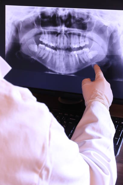 Best Emergency Root Canal Treatment in Saline, MI
