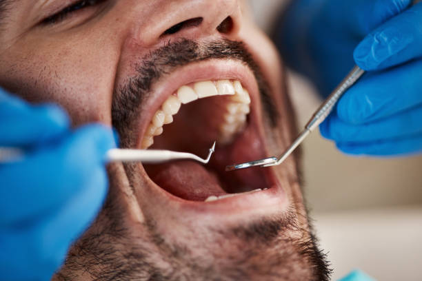  Saline, MI Emergency Dentist Pros